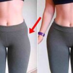 chirurgie esthétique des hip dips implique exactement