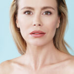 botox sillons nasogeniens