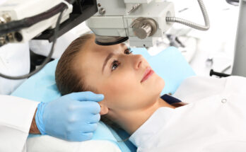 Chirurgie réfractive